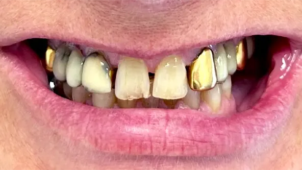 soik_pries